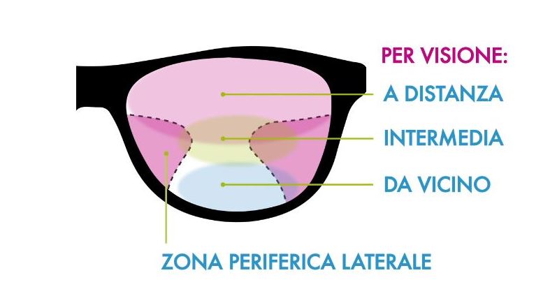 COSA È LA LENTE PROGRESSIVA?